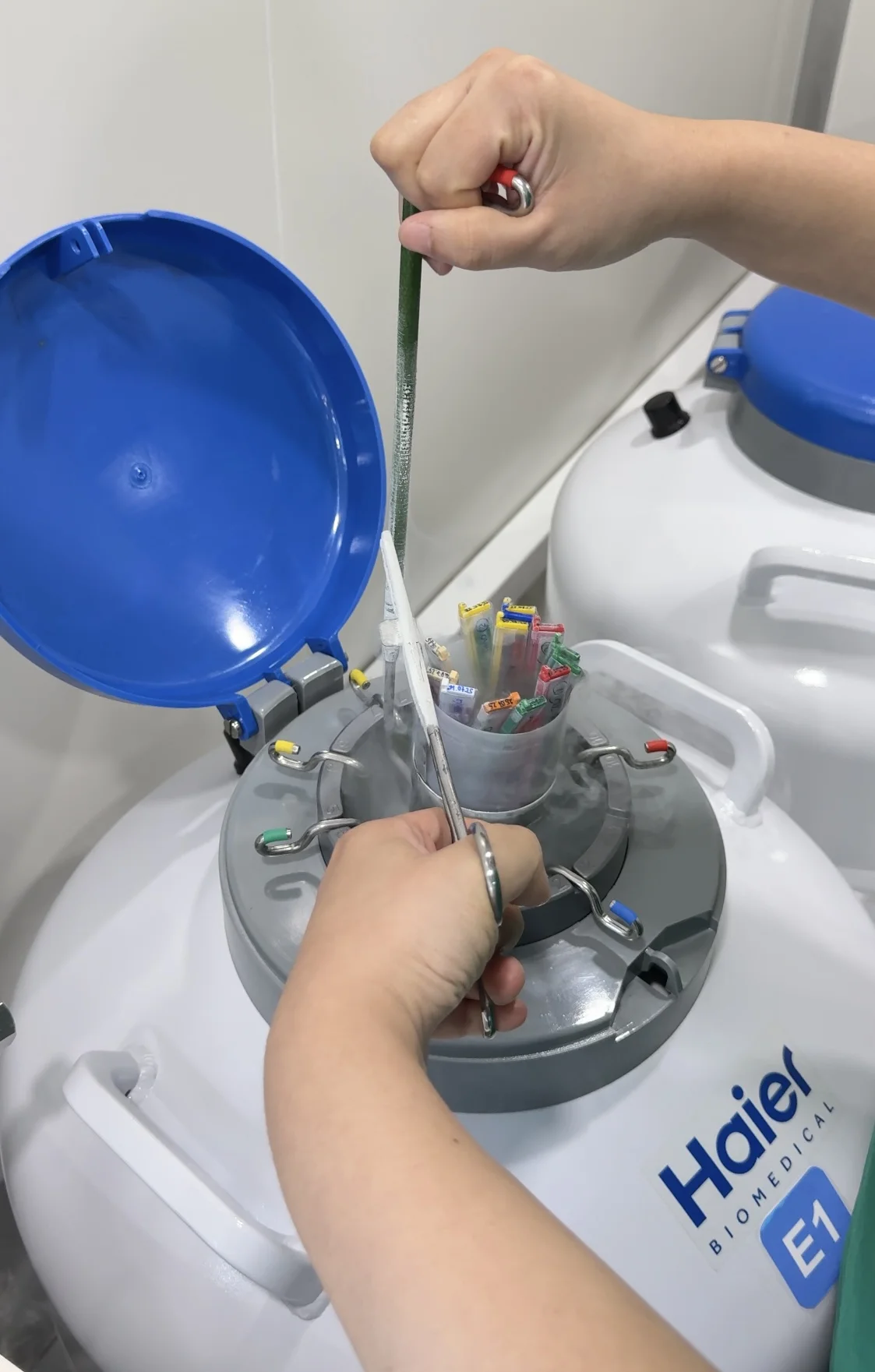 Trữ đông phôi để có thêm cơ hội thành công khi điều trị IVF