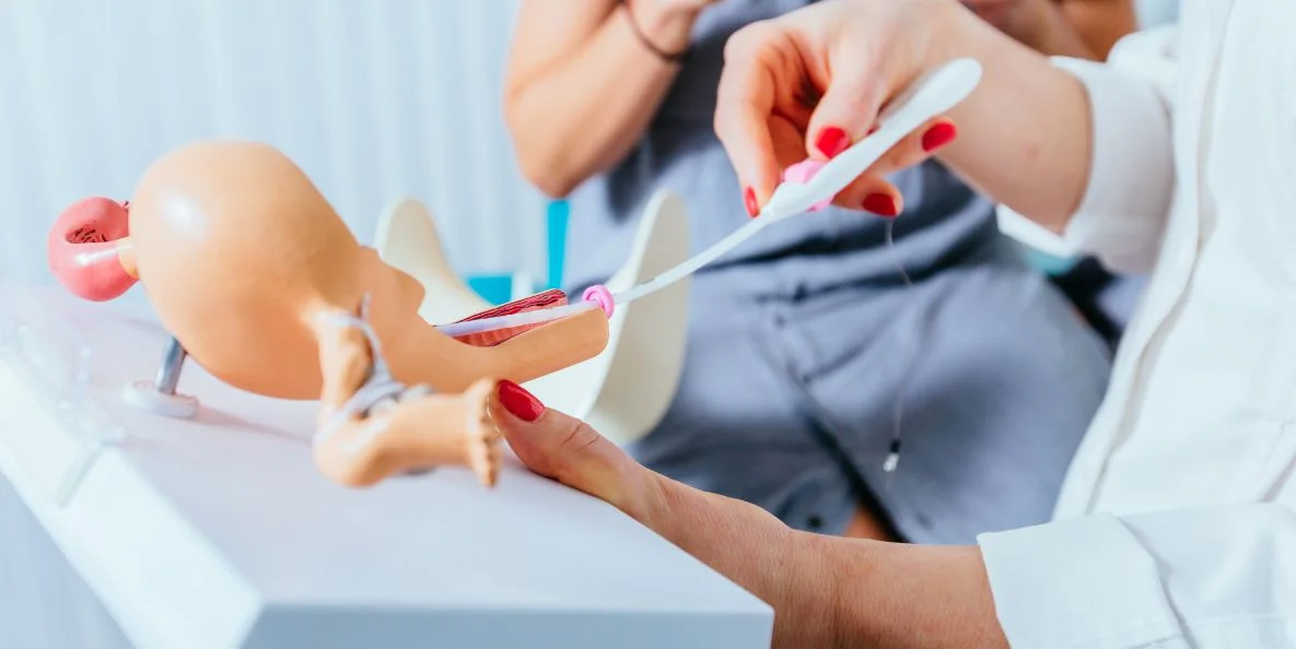 Cơ chế hoạt động của IUI là đưa tinh trùng trực tiếp vào buồng tử cung vào thời điểm rụng trứng