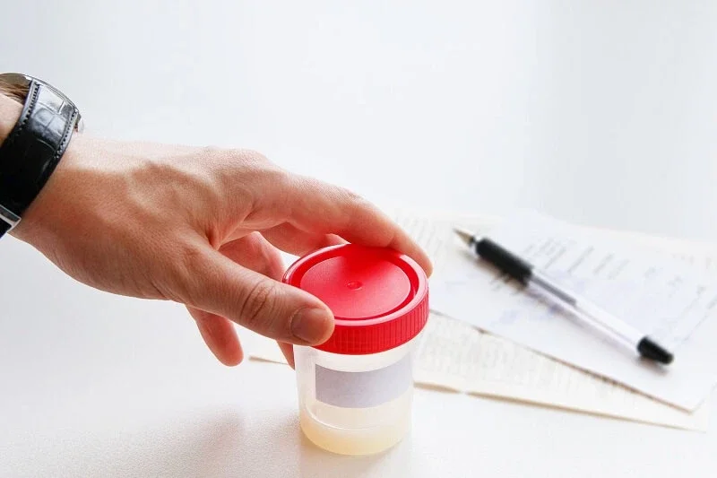 Xét nghiệm tinh dịch đồ để đánh giá chất lượng, số lượng, hình thái tinh trùng