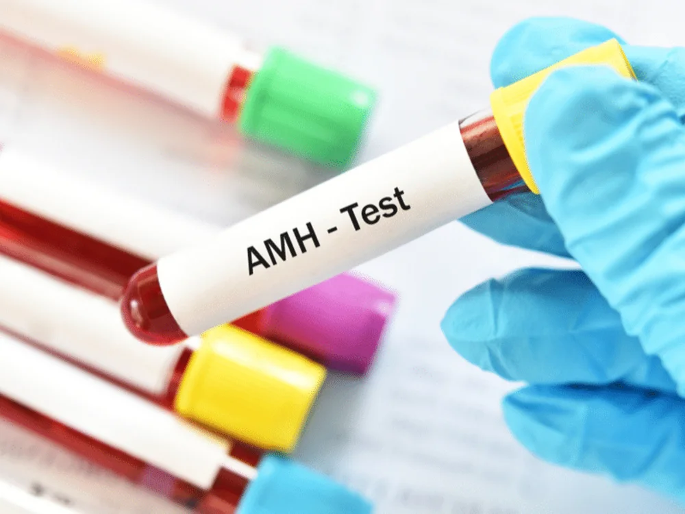 Xét nghiệm AMH có thể được thực hiện vào bất kỳ thời điểm nào