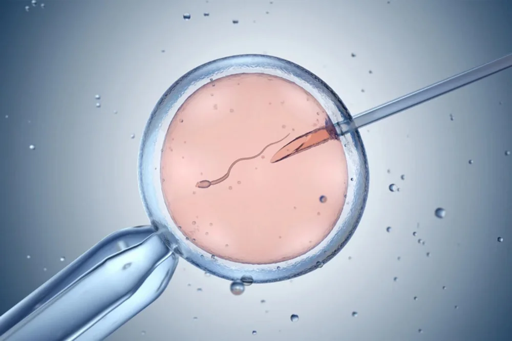 Phác đồ làm IVF của phụ nữ lớn tuổi cần được cá nhân hoá