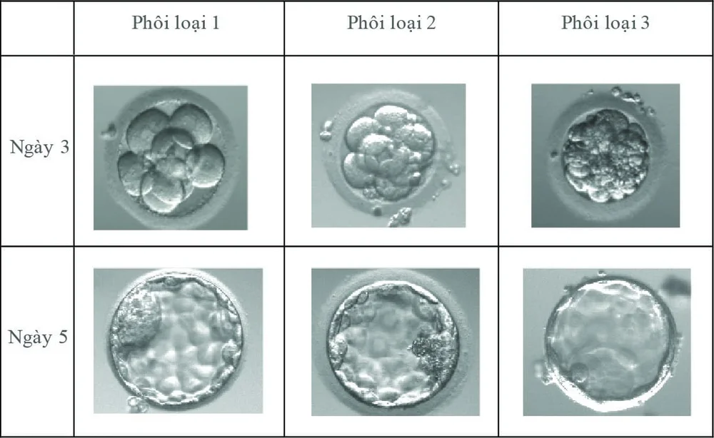 Phôi được đánh giá dựa trên số lượng tế bào, độ đồng đều và mức độ phân mảnh
